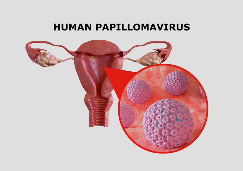 HPV e Saúde da Mulher