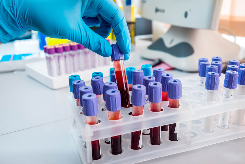 processos laboratório