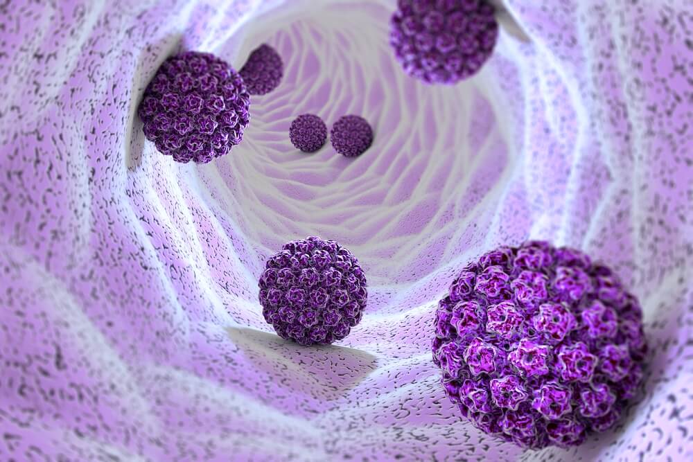 HPV Diagnóstico