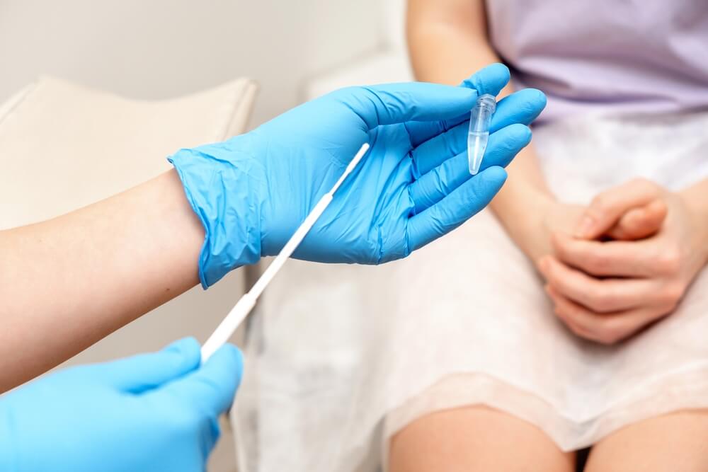 Diagnostico de HPV