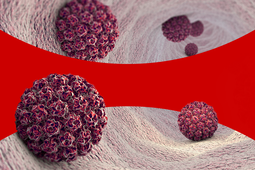 Como detectar o HPV